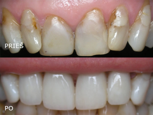 Estetinės odontologijos klinika UAB "Studio Dentis"