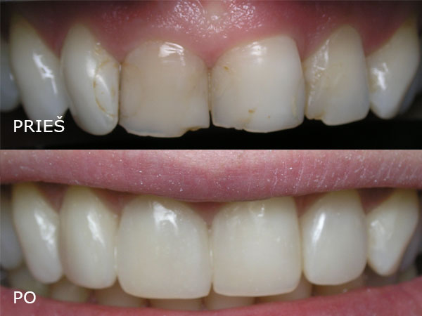 Estetinės odontologijos klinika UAB "Studio Dentis"