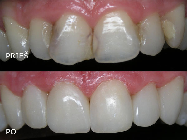 Estetinės odontologijos klinika UAB "Studio Dentis"
