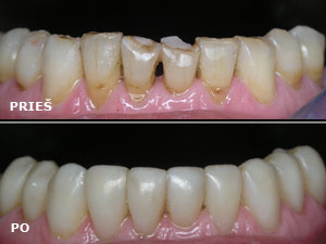 Estetinės odontologijos klinika UAB "Studio Dentis"