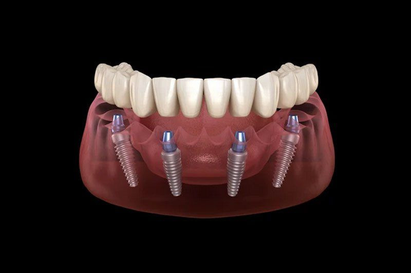 Denti, odontologijos klinika