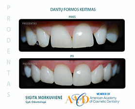 Prodentas, estetinės odontologijos klinika, UAB
