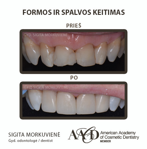 Prodentas, estetinės odontologijos klinika, UAB