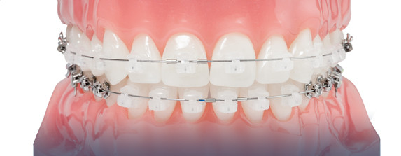 Denticus, UAB