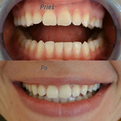 Aridentus, IĮ