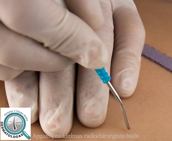 Gyd. V. Toliušio odos ligų ir estetinės medicinos klinika, Dermatologas