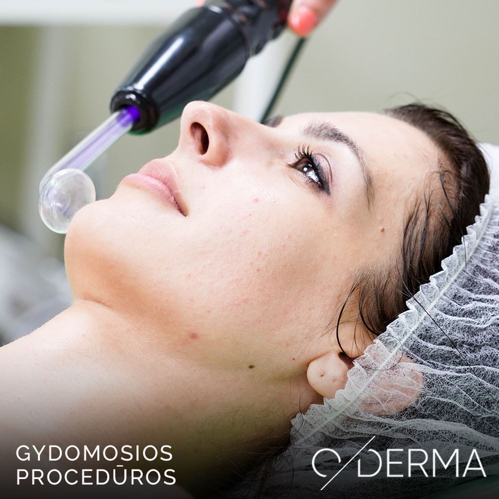 Oderma, UAB