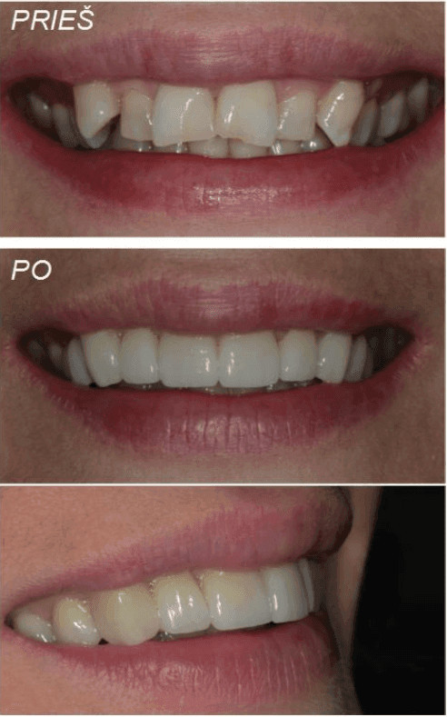 About smile, UAB
