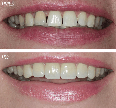 About smile, UAB