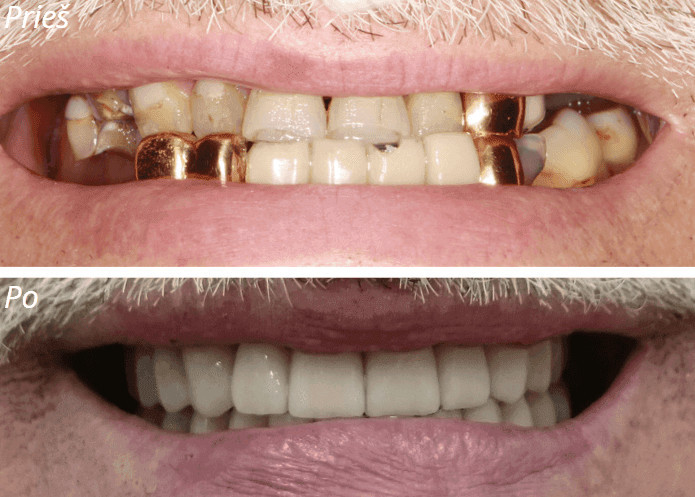 About smile, UAB