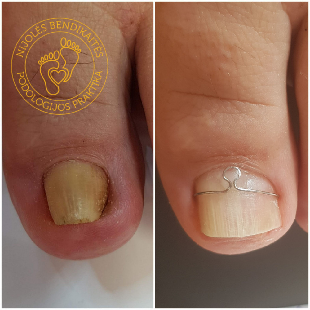 Nijolės Bendikaitės podologijos praktika, MB „Podologija“