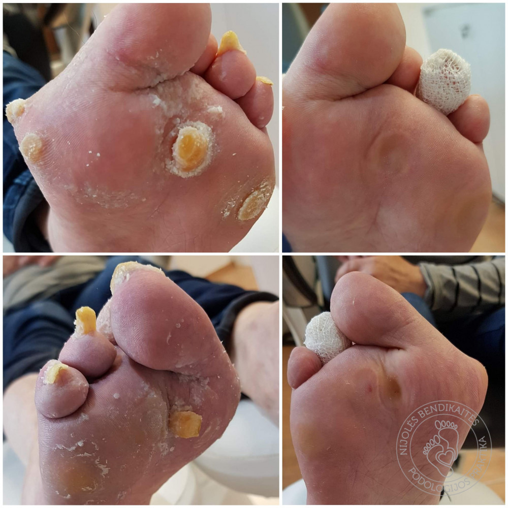 Nijolės Bendikaitės podologijos praktika, MB „Podologija“