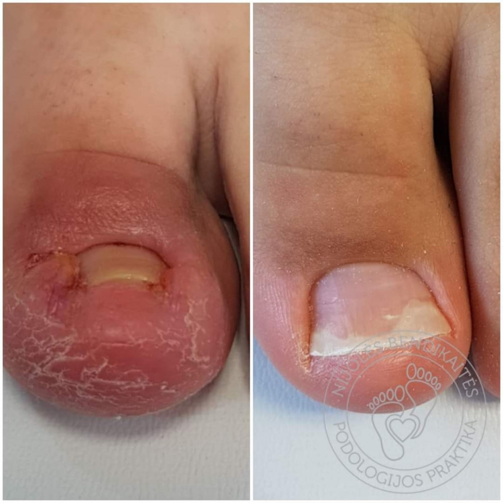 Nijolės Bendikaitės podologijos praktika, MB „Podologija“