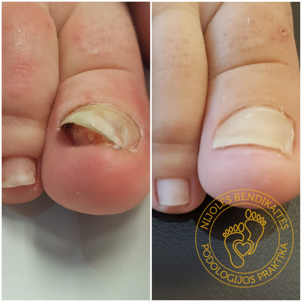 Nijolės Bendikaitės podologijos praktika, MB „Podologija“