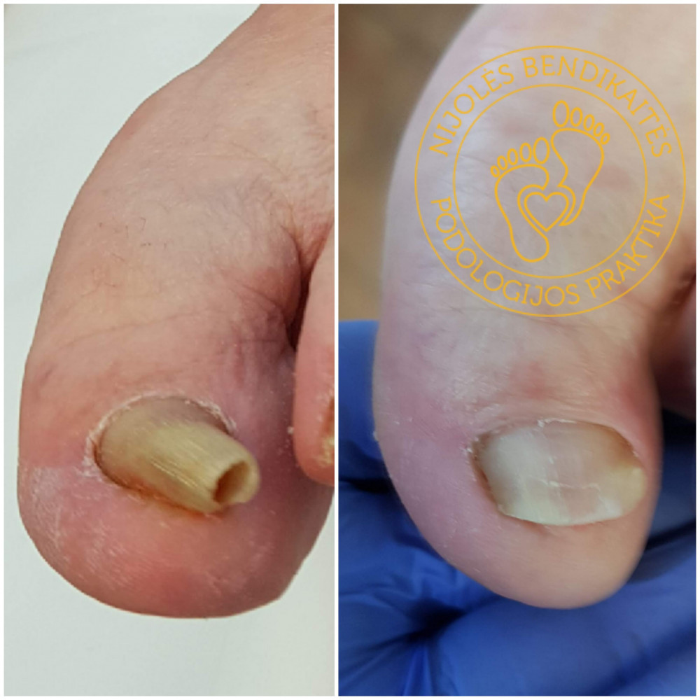 Nijolės Bendikaitės podologijos praktika, MB „Podologija“