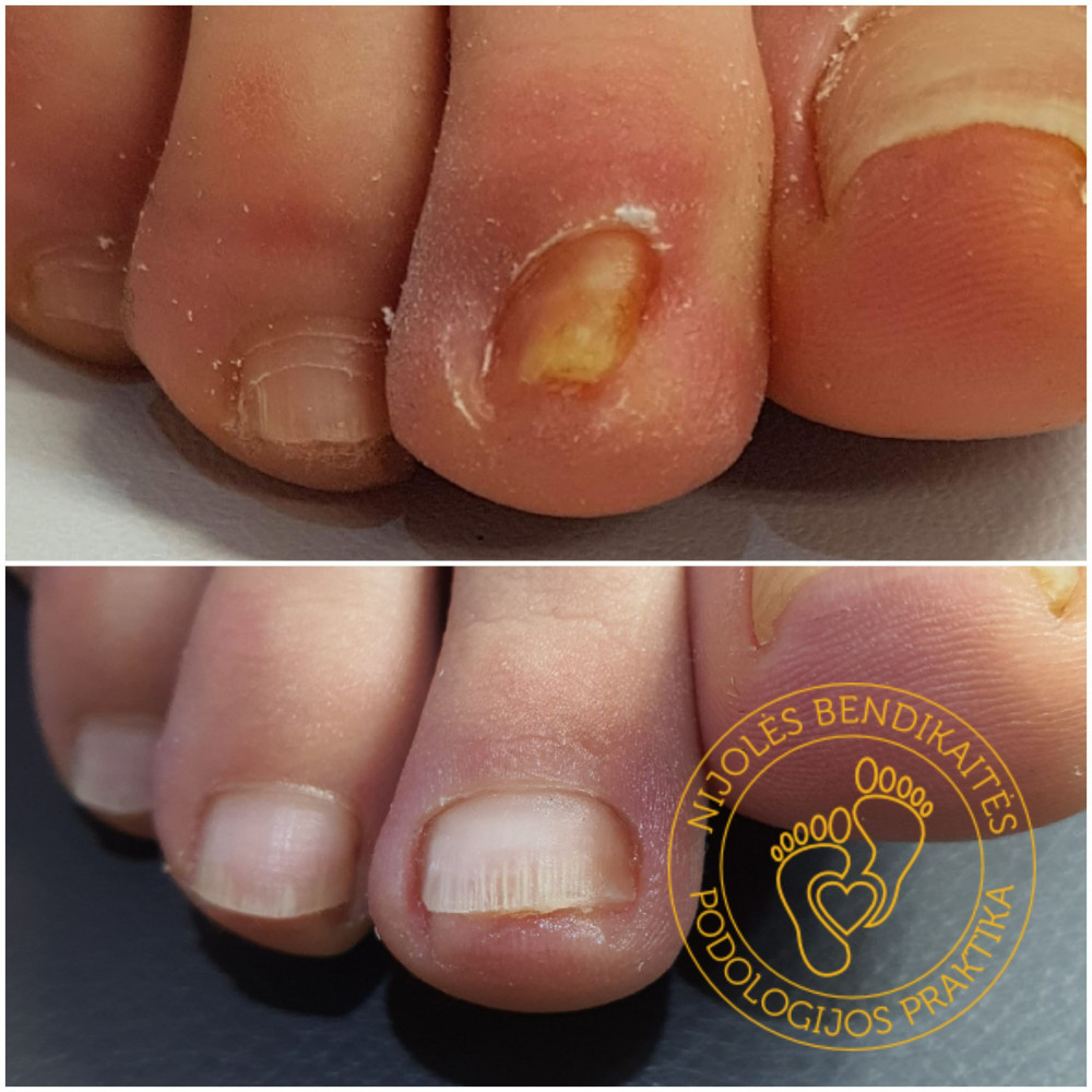 Nijolės Bendikaitės podologijos praktika, MB „Podologija“