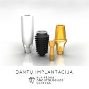 Dantų implantacija