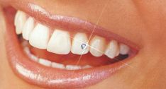 Dantų papuošalai – “deimantukai” įvairių spalvų, dydžių