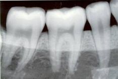 Skaitmeninės dantų nuotraukos