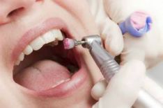 Burnos ir dantų chirurgija