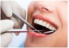 Dantų gydymas