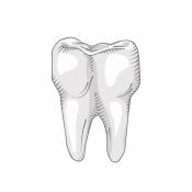 Dantų karieso gydymas