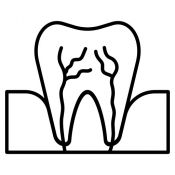 Endodontija