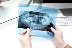 Dantų rentgenologija