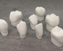 Implantacija, dantų implantavimas
