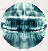 Rentgenologiniai tyrimai (dantų nuotraukos)