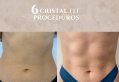 Raumenų ryškinimas, pilvo presas, apimčių mažinimas – Cristal Fit