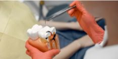 Dantų šaknų kanalų gydymas