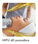 HIFU 4D procedūra
