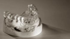 Dantų griežimo ir dilimo profilaktika