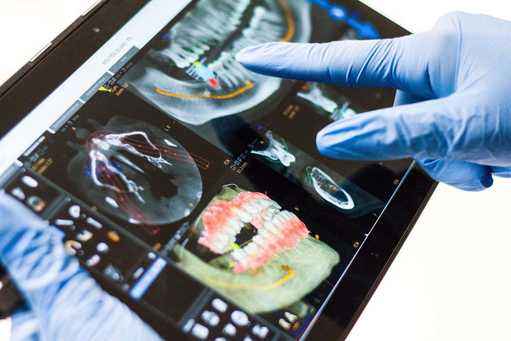 3D kompiuterinė tomografija - ką reikia žinoti?