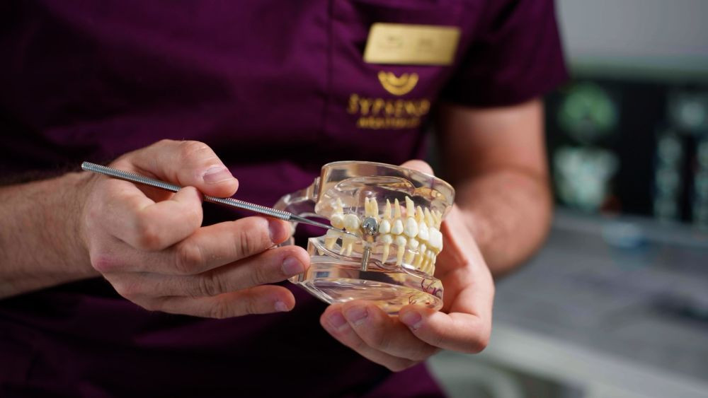 „Šypsenos akademijoje“ – itin žemos dantų implantacijos kainos