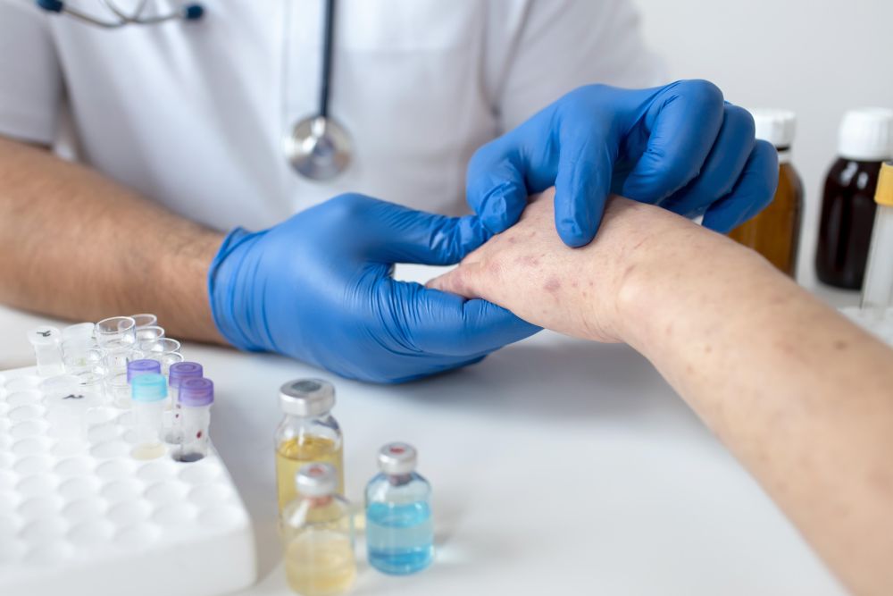 Kas yra melanoma? Kas yra melanoma?