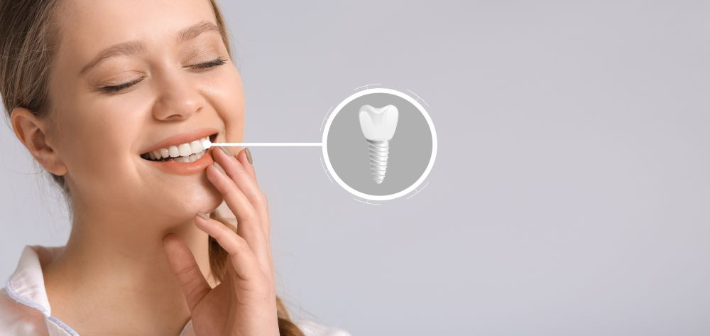 Implantavimas – pažangiausia technologija atstatyti prarastam dančiui